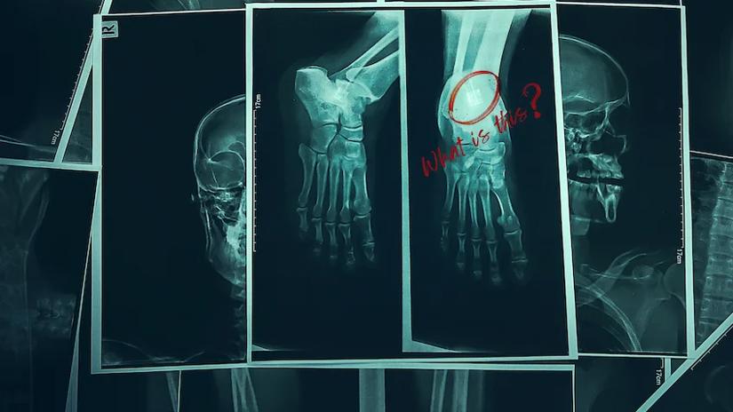 Immagine tratta da Files of the Unexplained: fenomeni inspiegabili