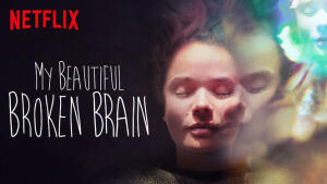 My Beautiful Broken Brain