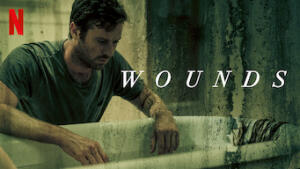 Wounds